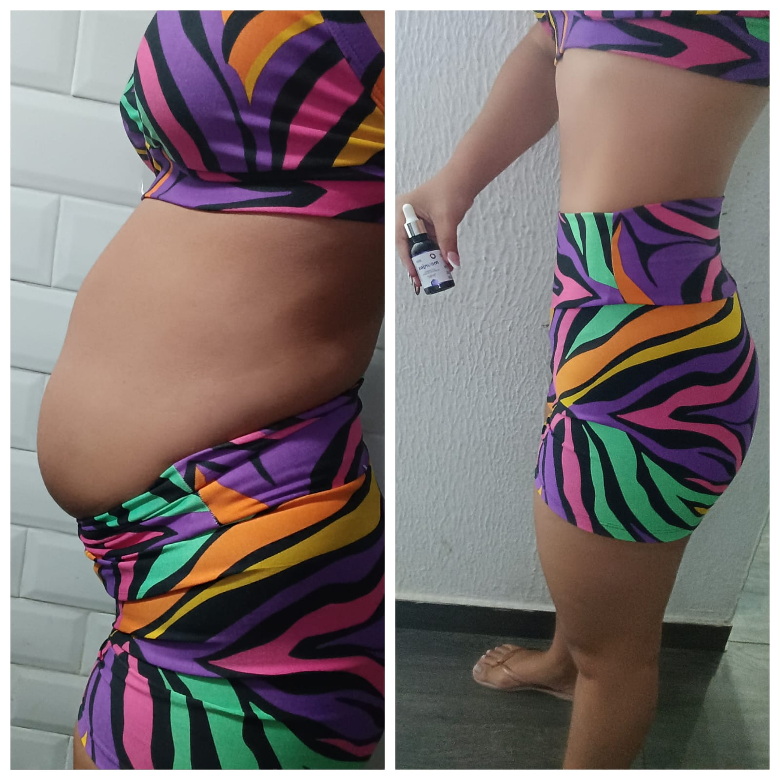 Antes e depois — foto 3