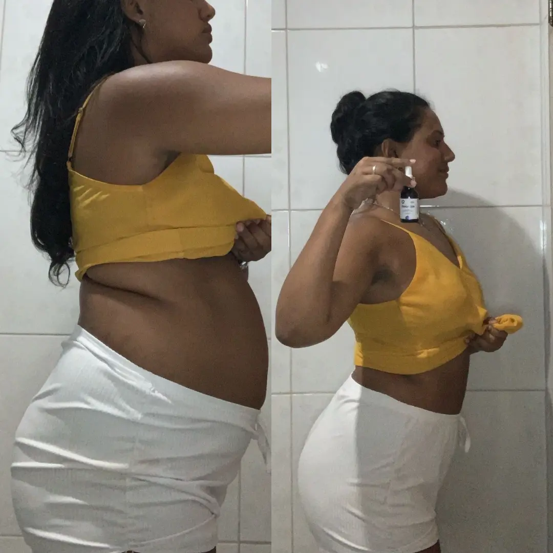 Antes e depois — foto 4